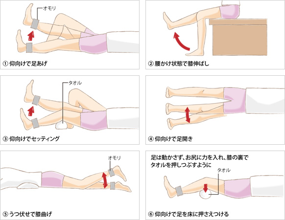 ひざ関節について 人工ひざ関節置換術 もっと知りたい 人工関節